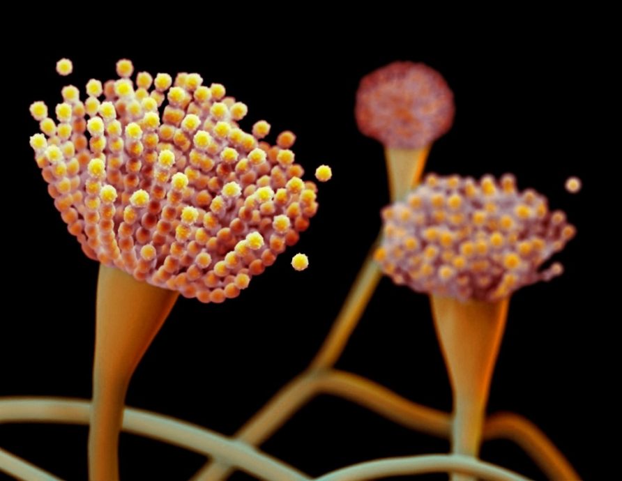 看世界)致命真菌扩散美国 “从内部吞噬人体”