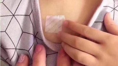 给孩子贴止咳贴被护士嘲笑 “她说像给钢铁侠电池充电”
