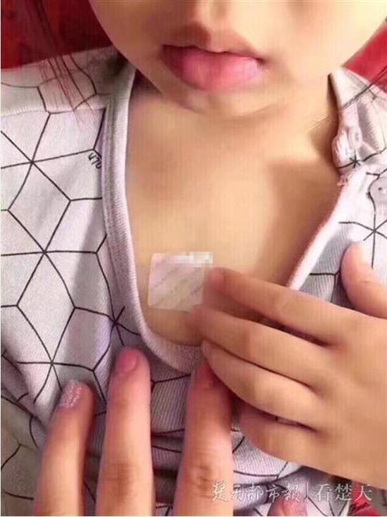 给孩子贴止咳贴被护士嘲笑 “她说像给钢铁侠电池充电”