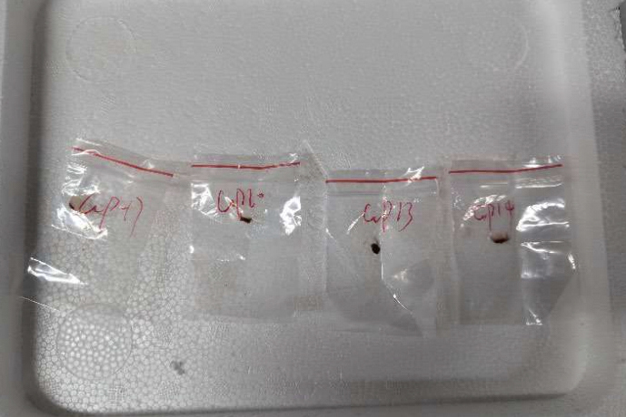 被指走私“农药恐袭”真菌赴美 两名中国研究人员遭起诉