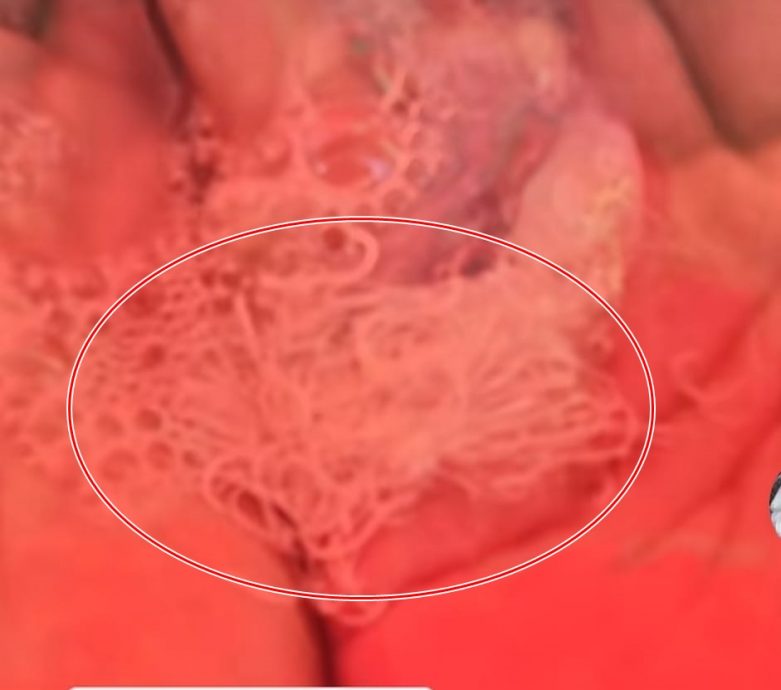 视频| 小贩示范清理技巧 99%乌贼内藏寄生虫