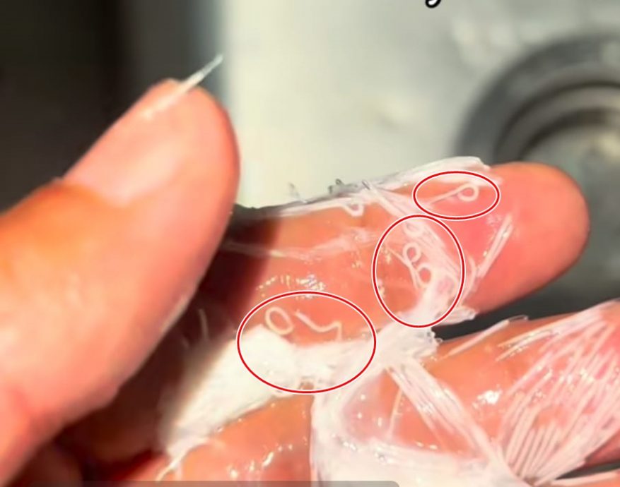 视频| 小贩示范清理技巧 99%乌贼内藏寄生虫