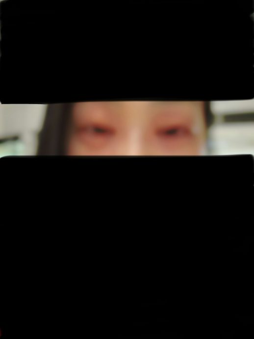 郭柏妍食物敏感眼部红肿 气管收缩：喘不过气