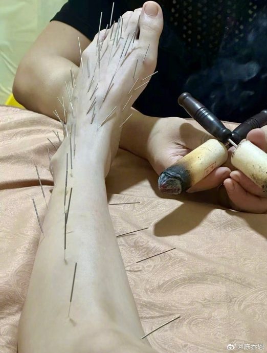 陈乔恩晒针雕保养像酷刑 网民看得头皮发麻