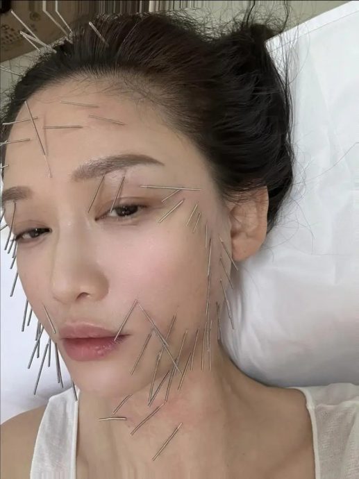 陈乔恩晒针雕保养像酷刑 网民看得头皮发麻