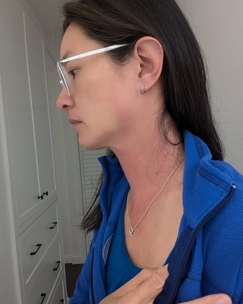 Janet高烧40度脖子大片红肿 医生无解上网求助