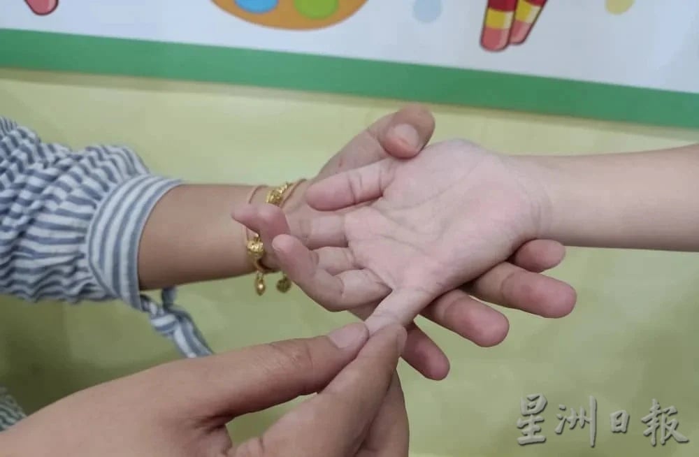 幼儿园严正以待不松懈 霹手足口症呈下降趋势 