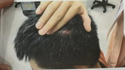 “我被打到缝针，还是说了对不起”男泪诉家暴地狱：还被索分手费