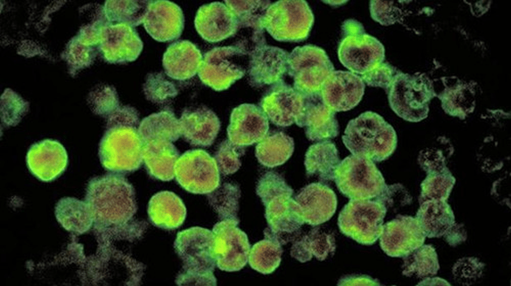 5岁女童感染“食脑虫”昏迷不醒 医生:死亡率达98%!