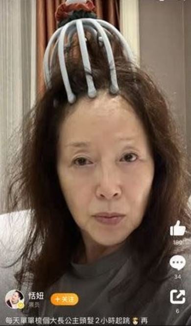 67岁恬妞脸颊圆润身形臃肿 演出《朝雪录》观众认不出是她