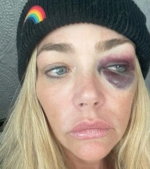 “前邦女郎”丹妮丝申请禁制令 呈证据指控被丈夫虐打