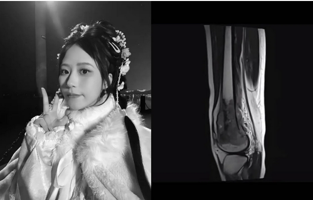 “我已化作微风与星光”22岁中国网红呆呆羊抗癌1610天病逝 感人遗言曝光:替我拥抱他们