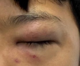 中三生教室内遭同学殴打至晕 实习教师在场目睹