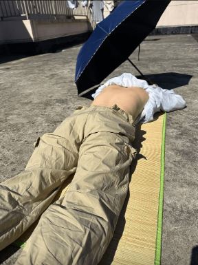 伏天晒背 不是人人适合!  浙女晒背9天减肥不成 反致急性肾衰竭  