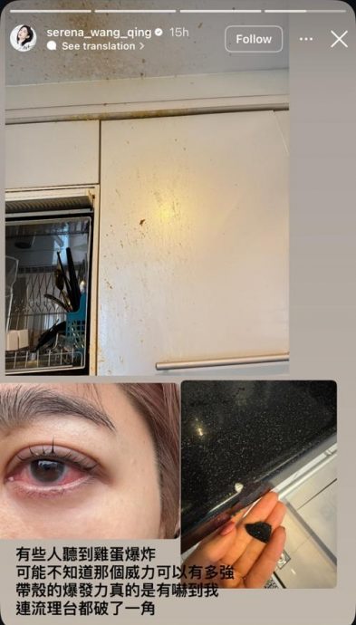 供星洲网：看视频学煮蛋酿爆炸 台女星眼角膜破裂脸烫伤