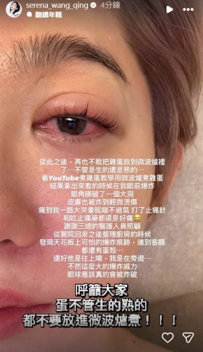 供星洲网：看视频学煮蛋酿爆炸 台女星眼角膜破裂脸烫伤