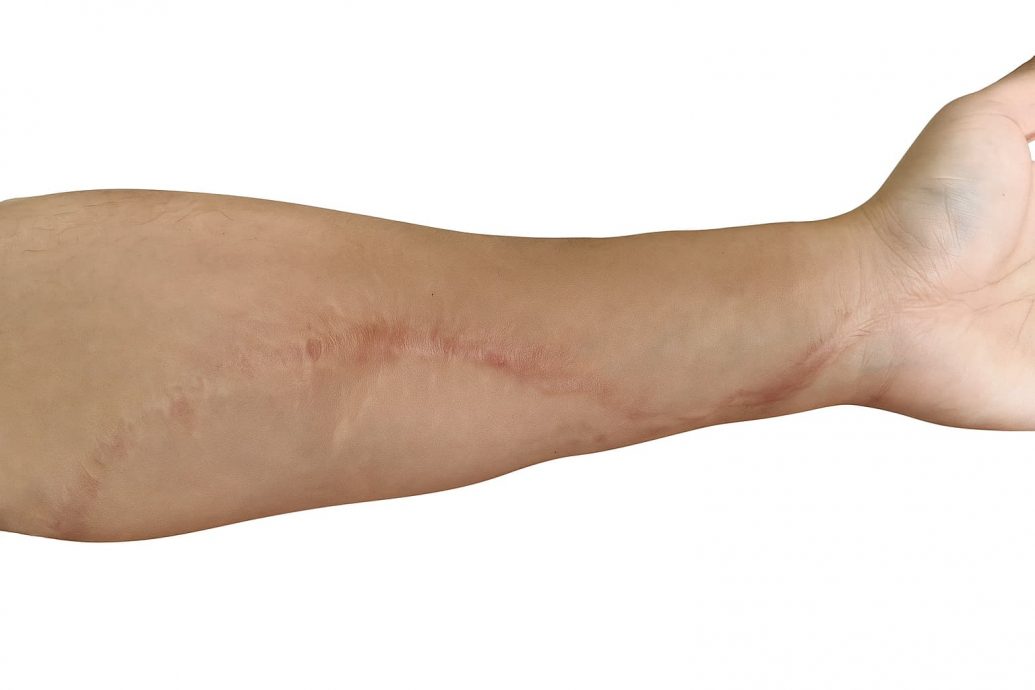 【暖势力】|“手残女子”蜕变翻糖蛋糕师  方嘉淇甜点填补人生裂缝