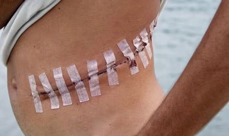 南非6岁男孩遭活摘器官 浑身血躺树林水沟