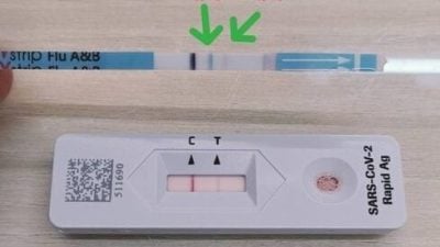 台8岁男童高烧39度就医　竟同时感染A流B流冠病