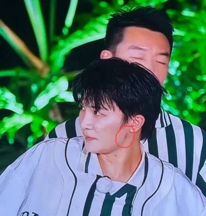 周深撕名牌遭拖行11秒受伤 《奔跑吧》节目组被骂翻