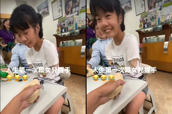 女儿装上义肢跟爸爸握手 父感动:“这一握等了12年”