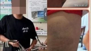 独家 | 9岁男童遭舅舅藤条鞭打 大腿满布瘀青红肿 警方追捕31岁男子