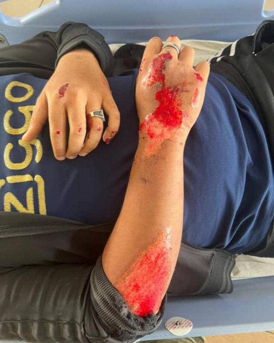 已签发//执勤交警切换车道撞摩托车 警：援引鲁莽驾驶条文调查