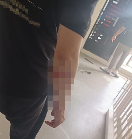 *已签发*柔:狮城二三事:与阿叔爆发冲突 追债员遭球杆打伤