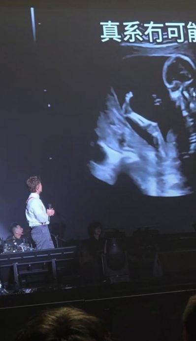 开唱公布老婆怀女儿 方力申呼难接受现实