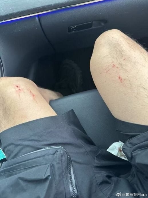 戴燕妮在巴黎被破窗抢劫 歹徒秒砸车窗夺包