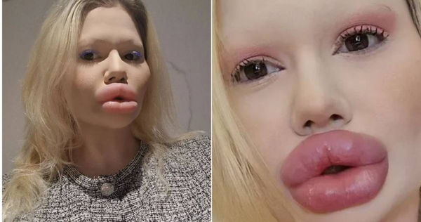 打造“世界巨唇”不顾生命危险