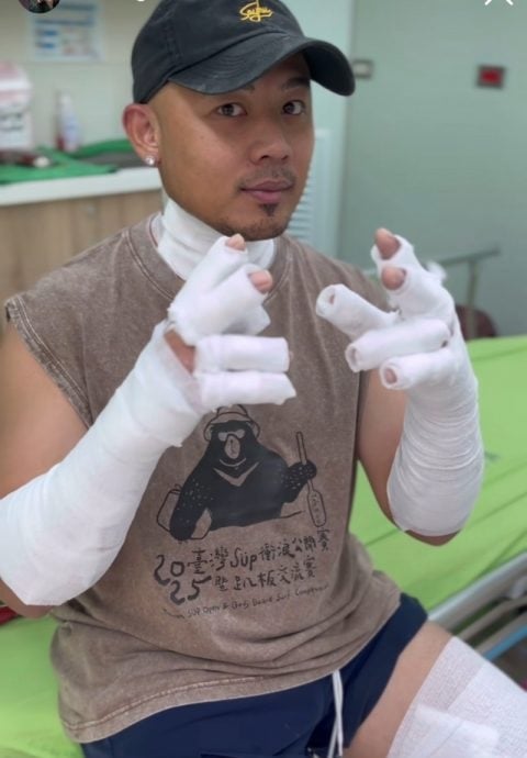 摊位气爆后仍心有余悸 纪晓君声带疲乏暂停演出