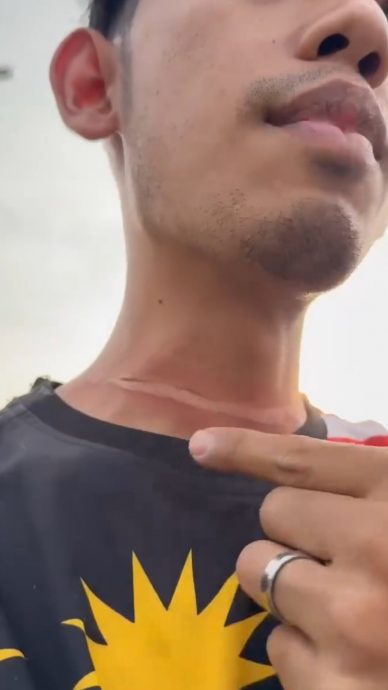 摩托车骑士遭风筝线勒伤脖子 林立迎：大道旁放风筝是危险行为