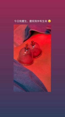 李幸倪突病倒拔罐放血 IG晒血照叹:庆祝我还有生命