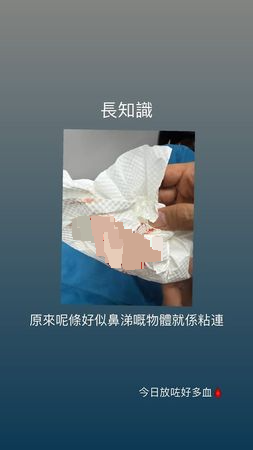 李幸倪突病倒拔罐放血 IG晒血照叹:庆祝我还有生命
