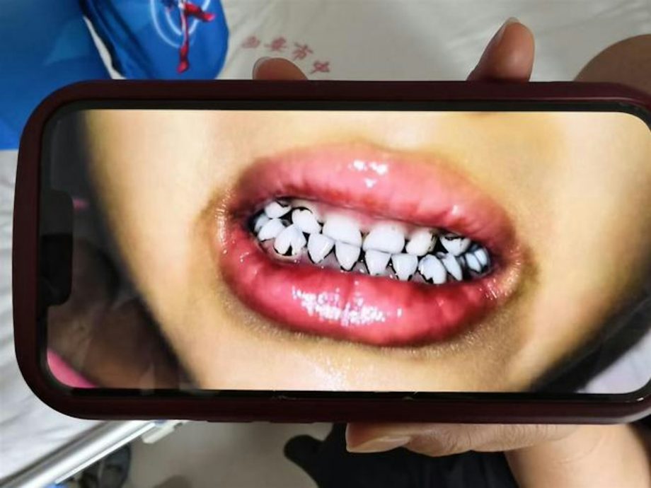 甘肃幼儿园铅中毒案调查出炉 6人被捕书记市长立案问责