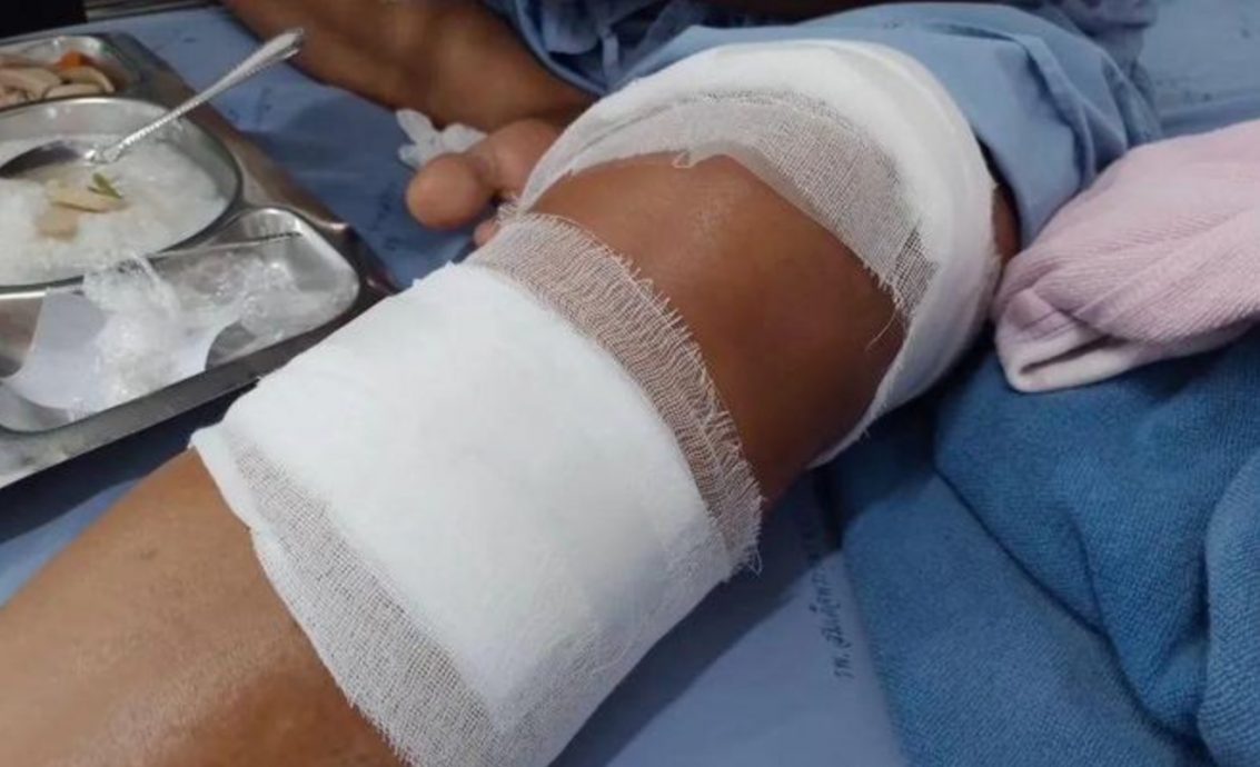 被眼睛王蛇咬伤竟徒手反杀 泰妇拎蛇尸冲医院自救