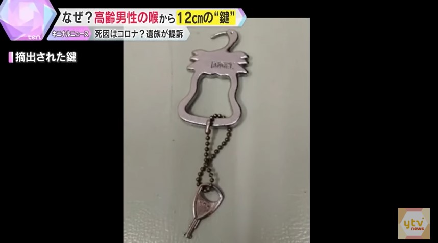 视频| 日82岁翁“喉咙痛”确诊冠病亡 X光竟发现钥匙卡喉咙