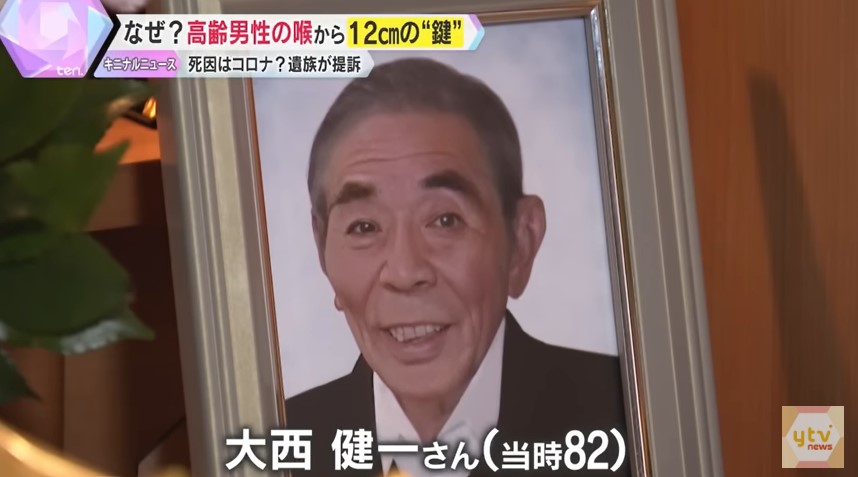 视频| 日82岁翁“喉咙痛”确诊冠病亡 X光竟发现钥匙卡喉咙