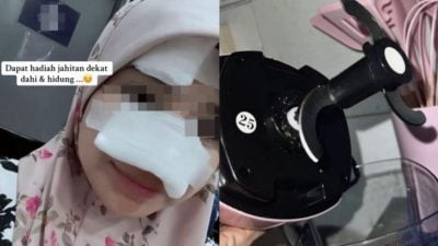 视频|遭搅拌机刀片飞击 女子额头鼻子缝11针险毁容