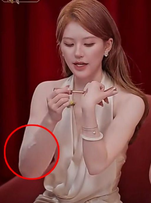 赵露思开直播手臂惊见白粉末 粉丝护航揭实情