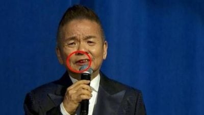 直播节目“嘴角有血”吓坏观众 陈建彬：牙龈出血没大碍