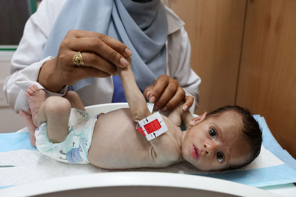 212人活活饿死“将近半数是儿童”　加沙营养不良又夺11命