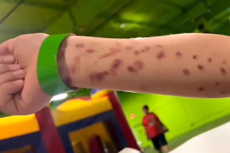 6岁童被水族馆巨型章鱼吸住　“3个大人才拔开”满手瘀伤画面曝