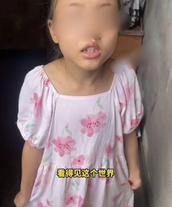 “妈，我几时能看到这个世界？” 失明女童一句话让母泪崩