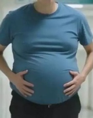 “青蛙肚”藏20公斤宿便 男子手术台上排便如山洪