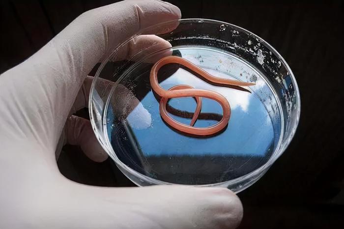 不只小孩 成人也有! 寄生虫入侵恐伤肝肺大脑!