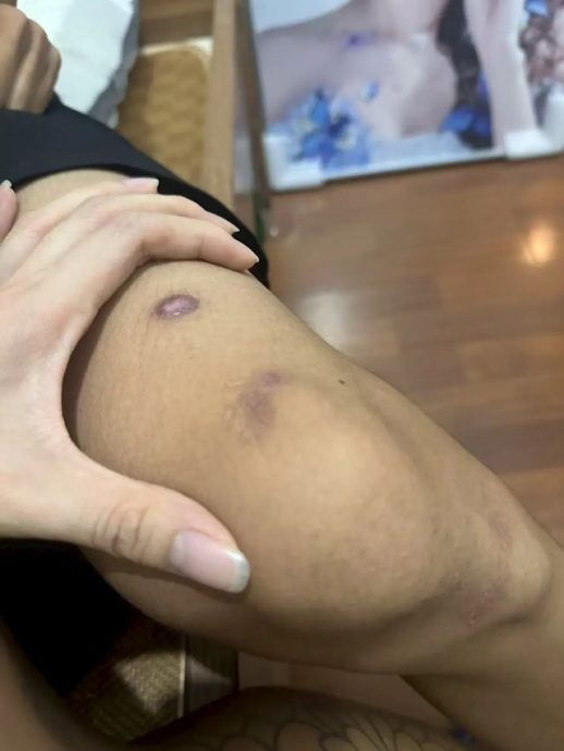 供星洲网：“恋爱脑”青年被17岁女友10万元“卖猪仔” 家属盼严惩