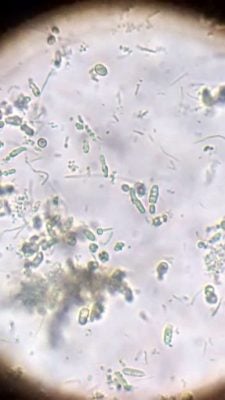 倒环保酵素净化湖水《星洲日报》迈向永续未来一大步！