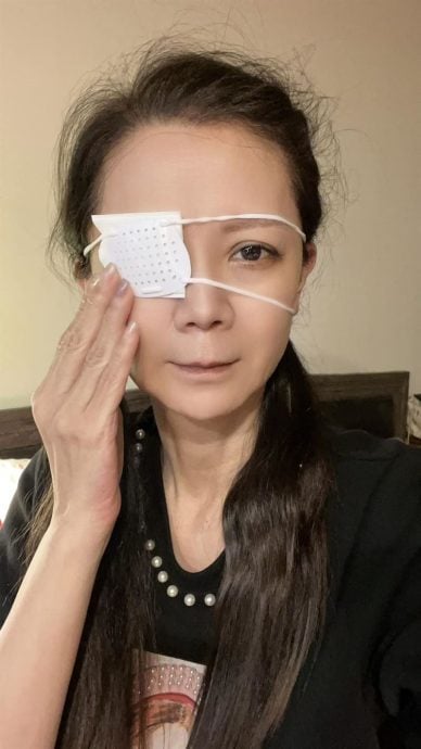 女星点错药水 右眼被灼伤险失明